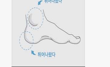 발뒤꿈치가 가는 사람